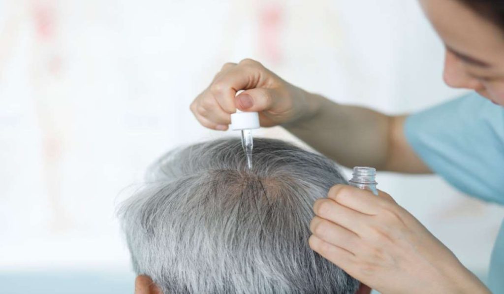 hair-loss-treatments