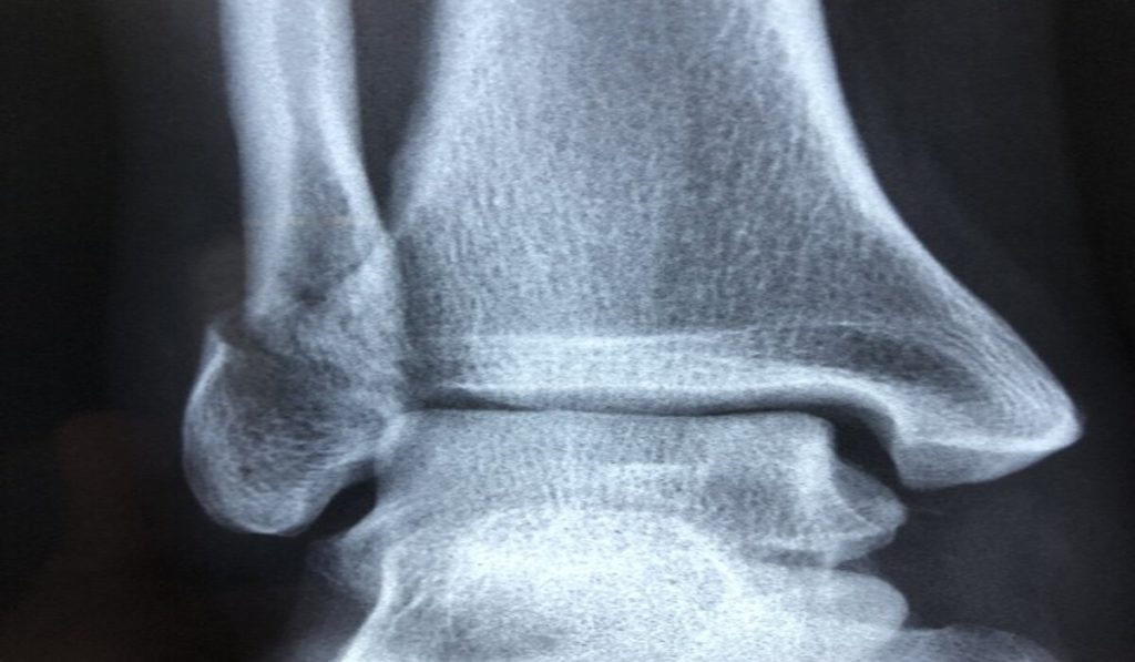 x-ray image of joint