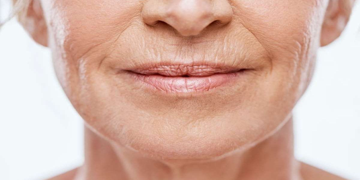 wrinkles-above-lips