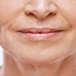 wrinkles-above-lips